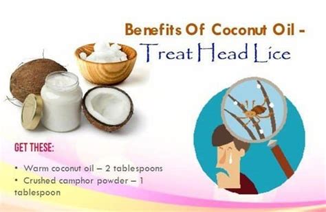 Miracle Natural Tips Coconut Oil For Lice Treatment Publication March