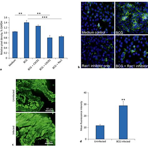 Mycobacteria Up Regulate Actin Distribution A B Bcg Induced Increased