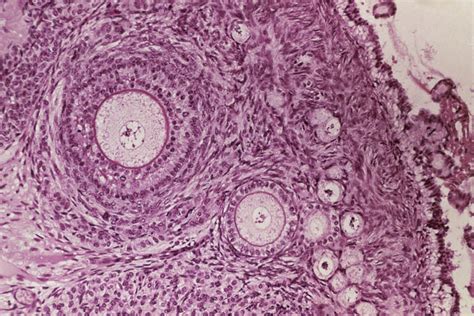 LM of section through an ovary showing follicles - Stock Image - P616 ...