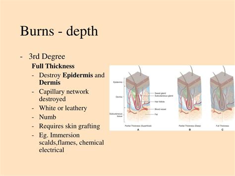 Ppt Wound Management Powerpoint Presentation Free Download Id3530101