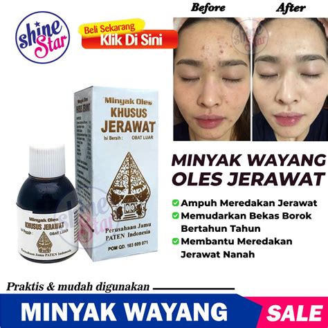 Jual SHINE STAR COD Minyak Oles Khusus Jerawat Cap Wayang Terbaik