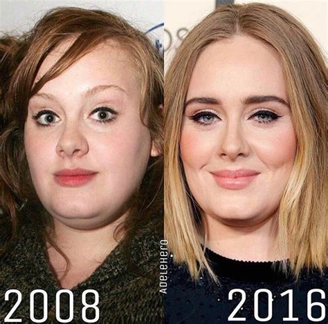 Adele Before And After Adele Before And After Celebrities Before