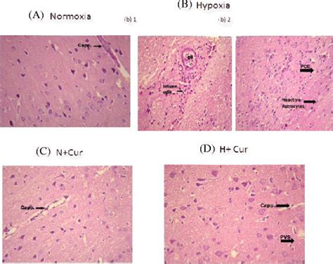 Histological Examination Of The Different Groups Of Rat Brain Tissues