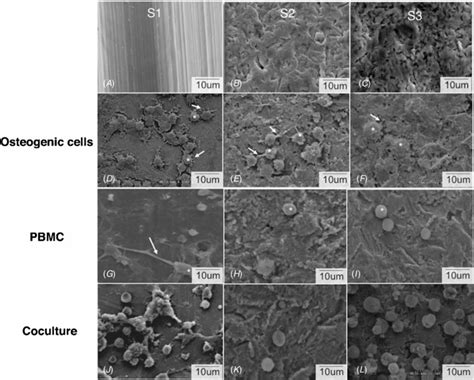 Scanning electron micrographs of the (A) S1, (B) S2 and (C) S3 ... 