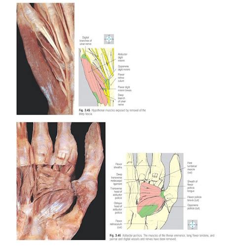 Palm And Digits Anatomy Pediagenosis Sesamoid Bone Deep Fascia