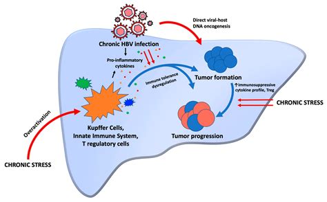 Hepatitis B Virus Associated Hepatocellular Carcinoma And Chronic Stress