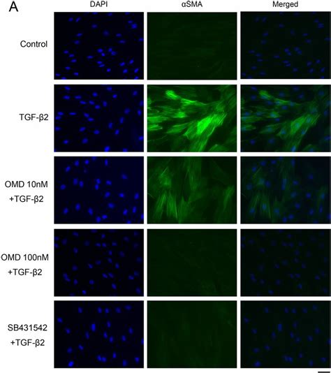 Effects Of Omd On Cytoskeletal And Fibrotic Protein Expression In Htm