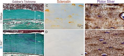 Loss of sclerostin increases CMF bone volume but does not affect the... | Download Scientific ...