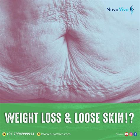 How To Prevent Loose Skin During Weight Loss Nuvovivo Reverse Your