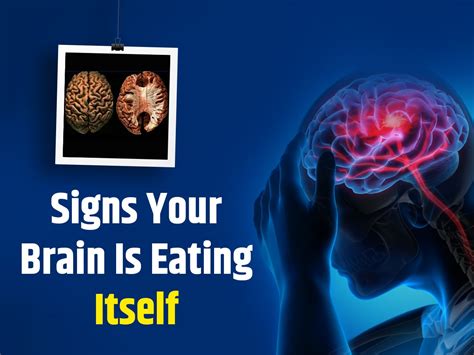 7 Warning Symptoms Your Brain Is Eating Itself | TheHealthSite.com