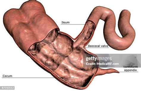 16 Ileocecal Valve Stock Photos High Res Pictures And Images Getty