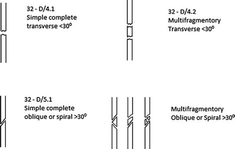 Paediatric Diaphyseal Classification System Download Scientific Diagram