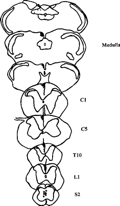 Figure 4 from Is there a pathway in the posterior funiculus that ...