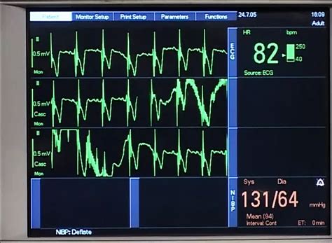 Vídeos pornô Gay de medico para xHamster