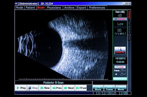 Ultrasound Eye Examination Photograph by Jim Varney/science Photo Library - Pixels