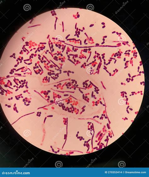 Yeast Cells and Hyphae in Gram Stain Fine with Microscope. Stock Photo - Image of coli, buds ...