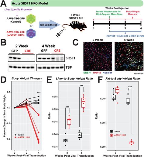 Splicing Factor SRSF1 Deficiency In The Liver Triggers NASH Like