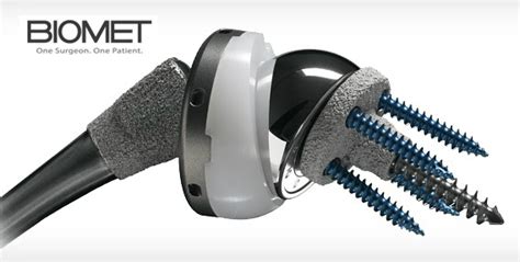 Biomet Shoulder Replacement Lawsuit