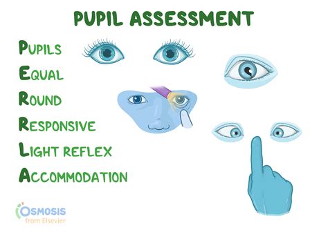 Perrla Pupil Assessment Acronym