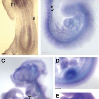 Expression Of Calpain In Whole Mount E Embryos Whole Mount In