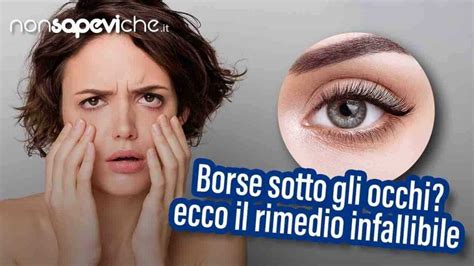 Borse Sotto Gli Occhi Fisse Al Mattino Ecco Il Rimedio Infallibile Nonsapevicheit