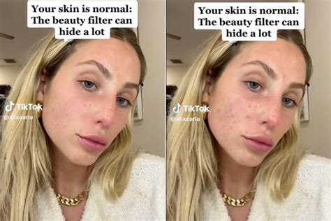 Alix Earle Shares Makeup Free TikTok Without Beauty Filter To Show Her