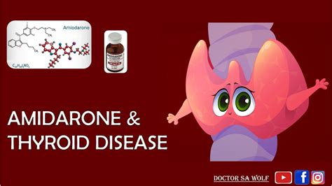 Amiodarone And Thyroid Disease Amidarone Induced Thyrotoxicosis