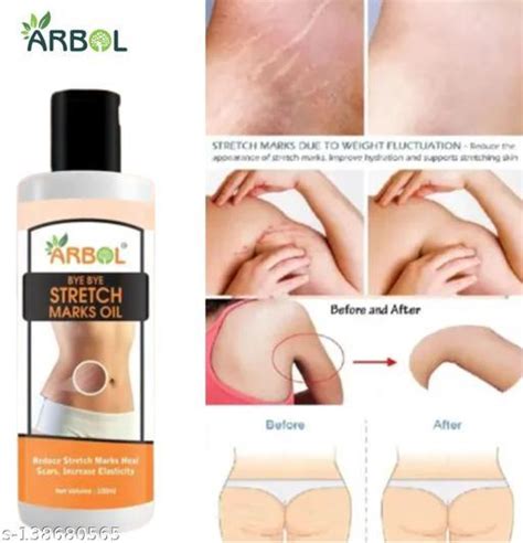 Arbol Present Repair Stretch Marks Removal Natural Heal Pregnancy