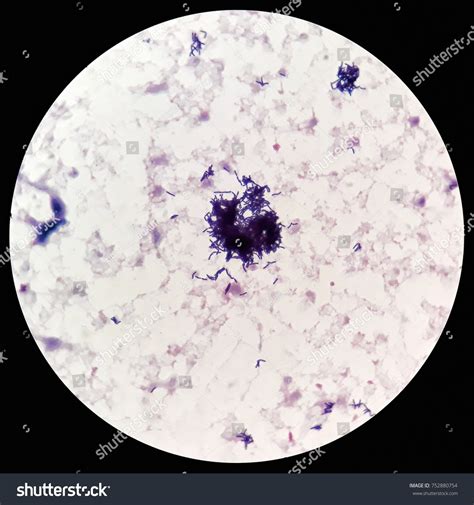 Smear Human Blood Culture Grams Stained Stock Photo