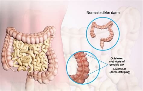 Health Condition Symptoms Causes Treatment And More