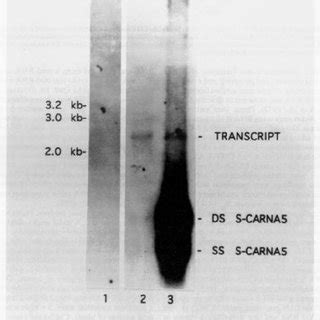 Northern Blot Hybridization Of Transgenic Plant RNA Poly A Enriched