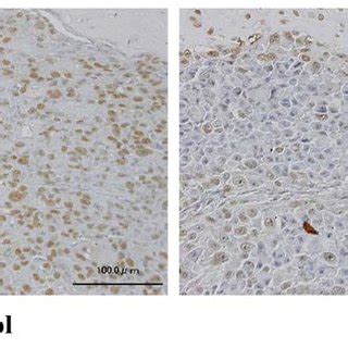 Immunohistochemical staining for HIF 1α in tibiae from both the CO 2