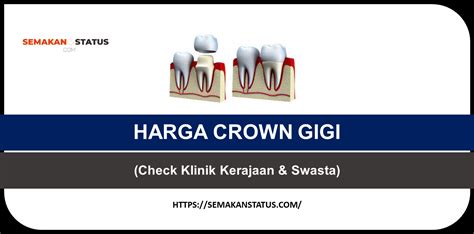 SENARAI HARGA CROWN GIGI MALAYSIA TERKINI 2024 Check Klinik Kerajaan