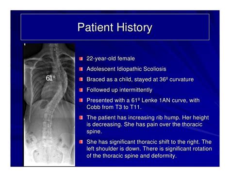 Case Review 4 Adolescent Idiopathic Scoliosis With 61 Degree Curvat