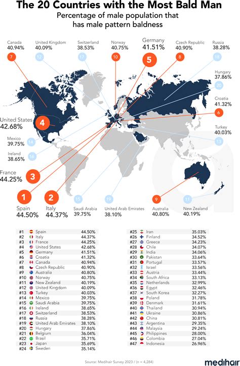 География мужского облысения: kireev — LiveJournal