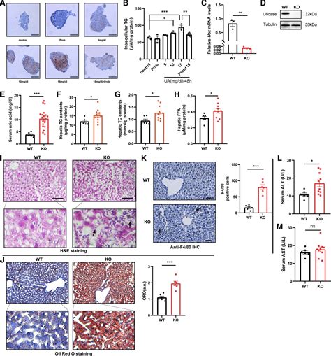 High Uric Acid Induces Liver Fat Accumulation Via Ros Jnk Ap