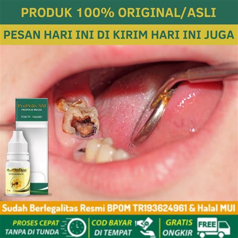 Jual Obat Gigi Berlubang Nyeri Linu Gusi Bengkak Sakit Gigi Nyut