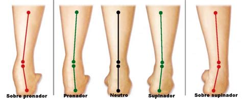 Pisada Pronadora Y Supinadora Dr Gabriel Monterrubio