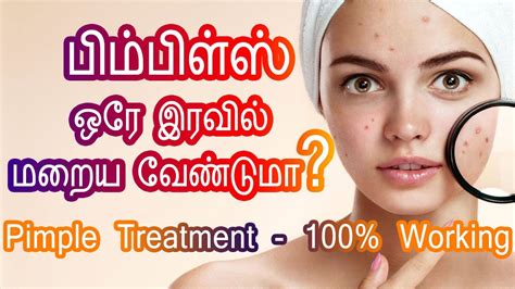 Pimple Treatment In Tamil Cure Pimples முகப்பரு மறைய Mugaparu Maraiya Tamil Beauty Tips