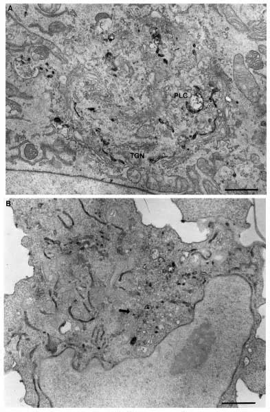 Immunoelectron Microscopic Analysis Of NDGAstimulated Retrograde