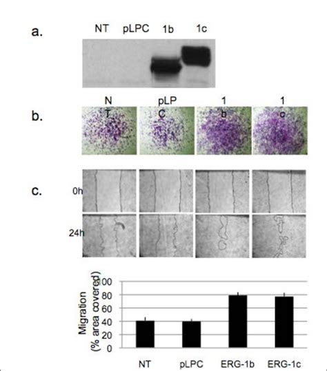 Effect Of Expression Of Erg Variant In T Cells Variants B