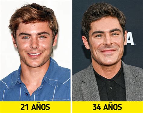 Zac Efron Explica Qué Le Pasó Realmente A Su Cara Y Responde A Los