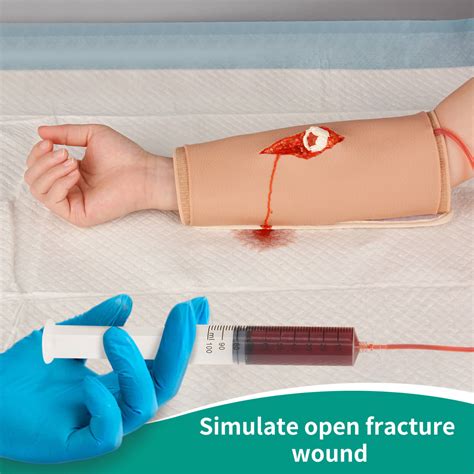 Wearable Open Fracture Wound Packing Trainer, 2nd-5th Grade – MedEduQuest