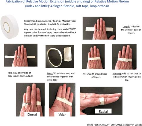 Relative Motion Orthoses A Five Question Decision Making Tool For