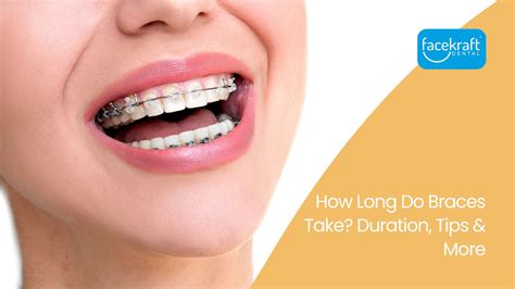 How Long Do Braces Take Duration Tips More Face Kraft Clinic