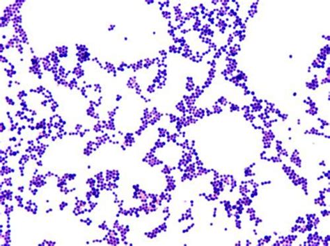 Staphylococcus Aureus Gram Stain 100x