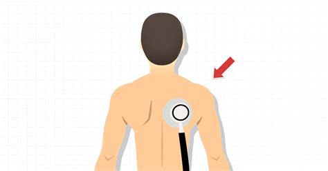 Why Doctors Listen to Your Back with a Stethoscope? (2024)