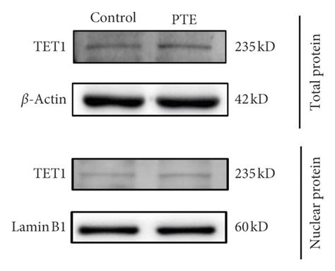 Effect Of Pte On Global 5hmc Levels And Tet1 Expression A