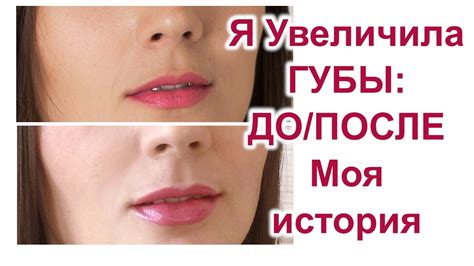 Фото половые губы после вакуумной помпы