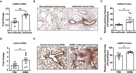 Frontiers G Protein Coupled Receptor Kinase 2 GRK2 Regulates T Cell